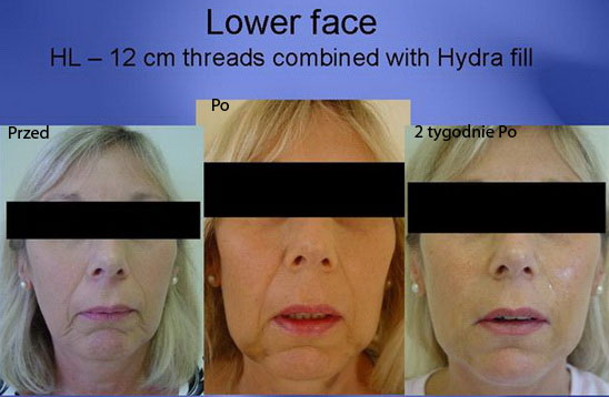 Medyczne newsy